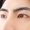eyelid-surgery-banner